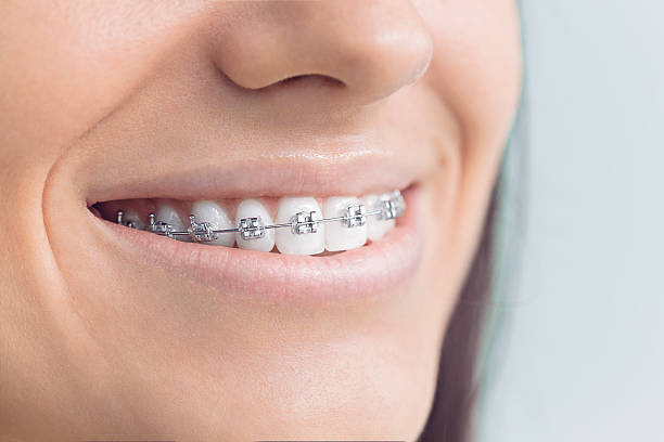 Best Traditional Braces  in Bluff City, TN